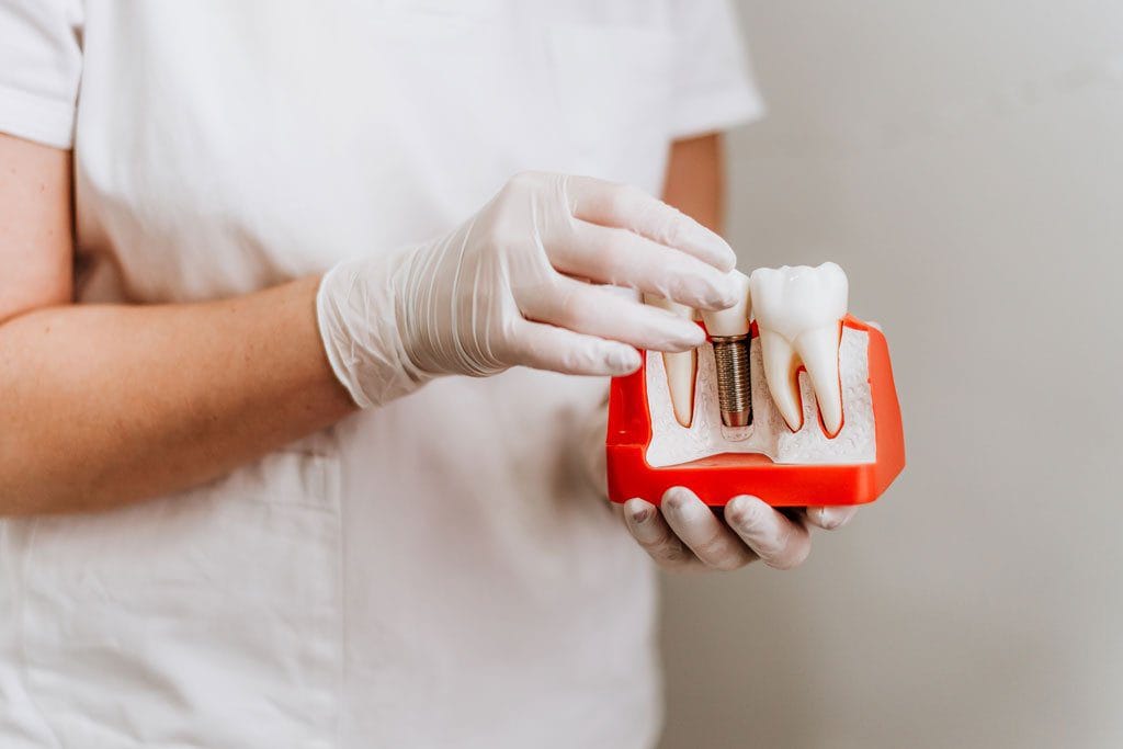 1 Günde Diş Implantı 13 bir gunde dis implanti