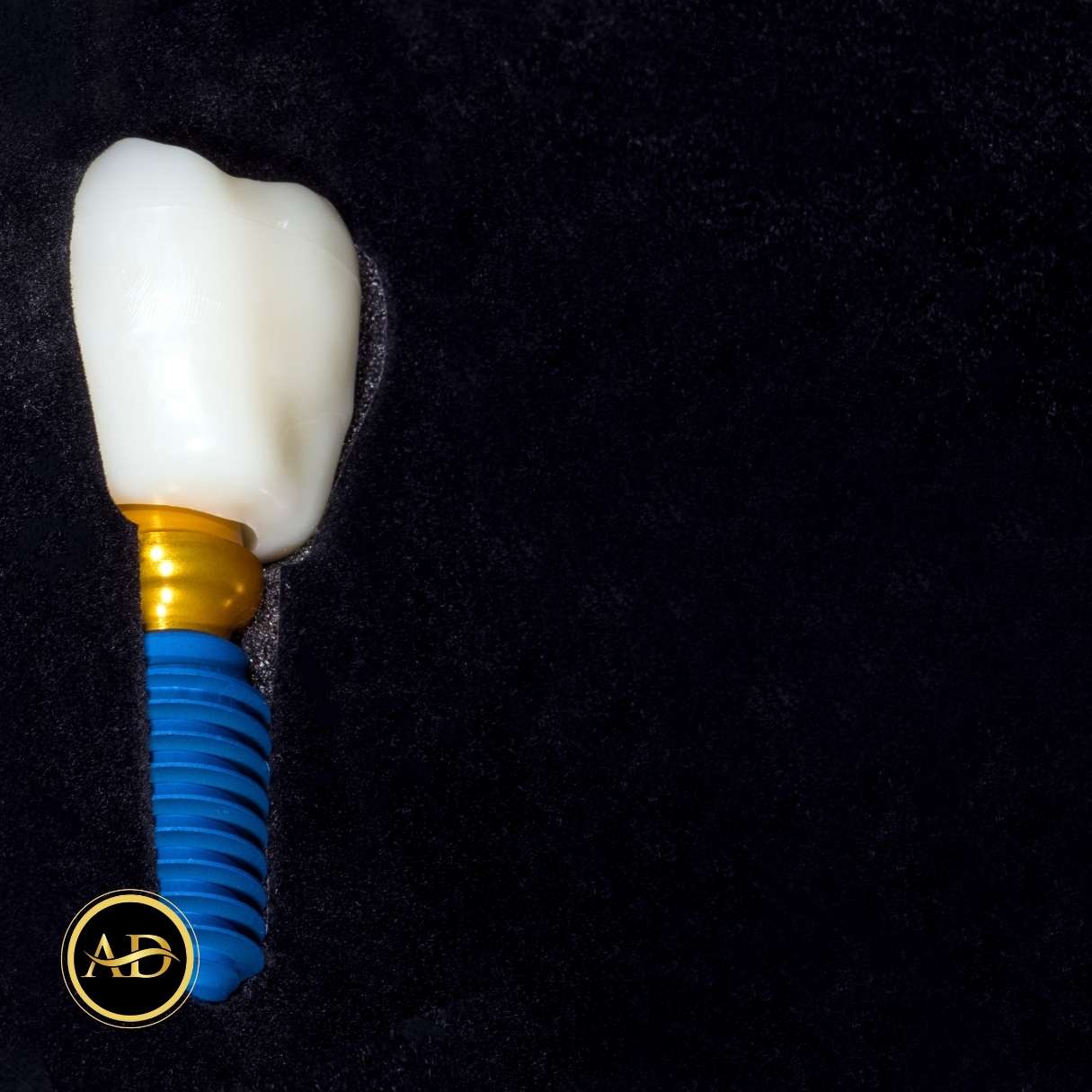 1 Günde Diş Implantı 19 aninda dis implanti