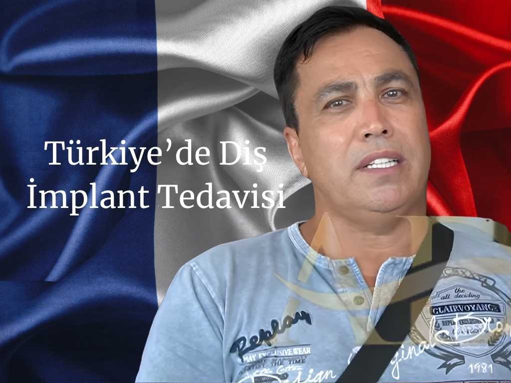 Implants dentaires All-on-4 16 Image