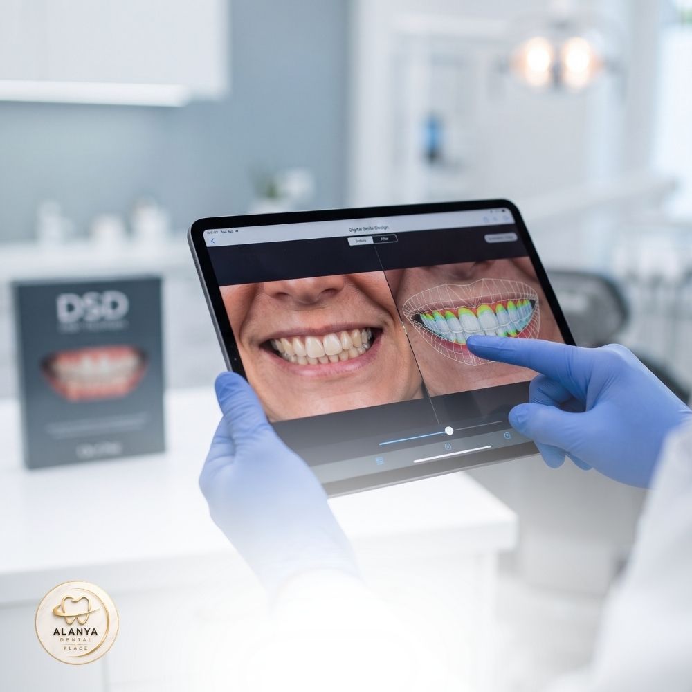 Hollywood Gülüşü 3 hollywood smile turkiye 2